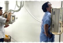 Tak Perlu Ke Luar Negeri, Indonesia Perkuat Pengobatan Kanker Dengan MDT Terpadu Tak Perlu Ke Luar Negeri, Indonesia Perkuat Pengobatan Kanker Dengan MDT Terpadu